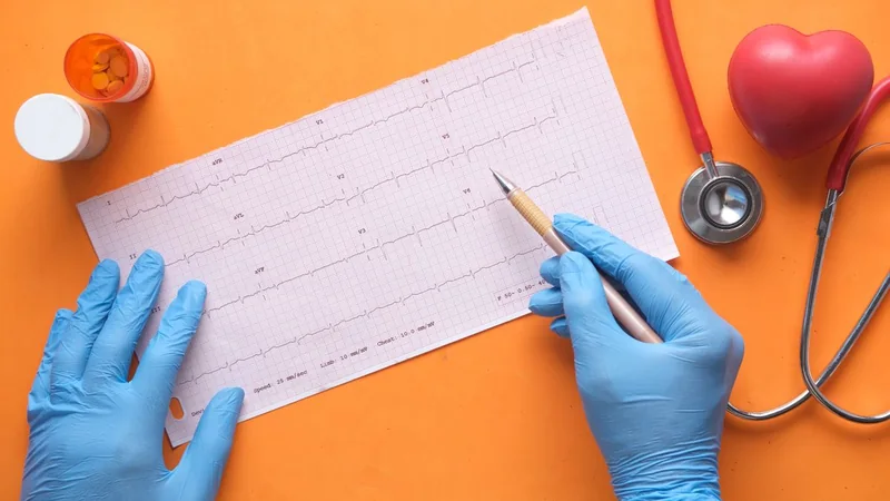 Lettura di un ECG; il tracciato non illustra una diagnosi di sincope